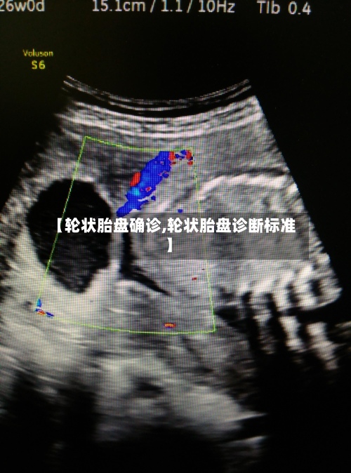 【轮状胎盘确诊,轮状胎盘诊断标准】-第2张图片