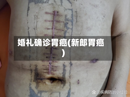 婚礼确诊胃癌(新郎胃癌)-第2张图片