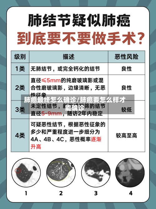 肺癌最终怎么确诊/肺癌要怎么样才能确诊