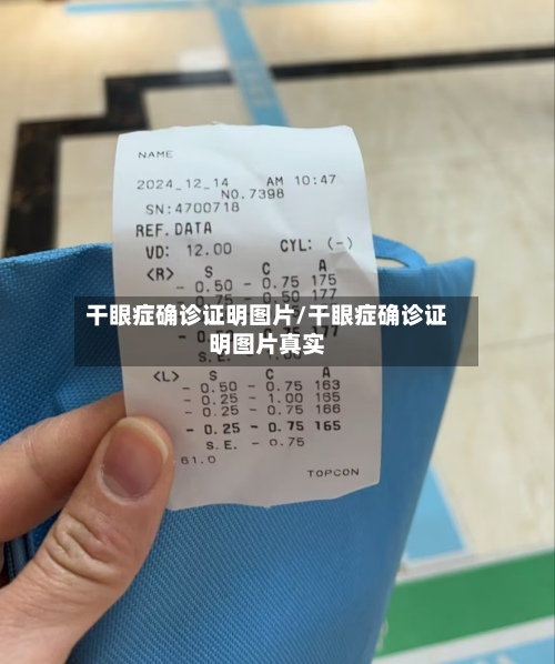 干眼症确诊证明图片/干眼症确诊证明图片真实