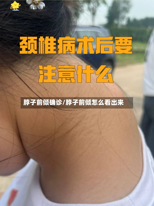 脖子前倾确诊/脖子前倾怎么看出来