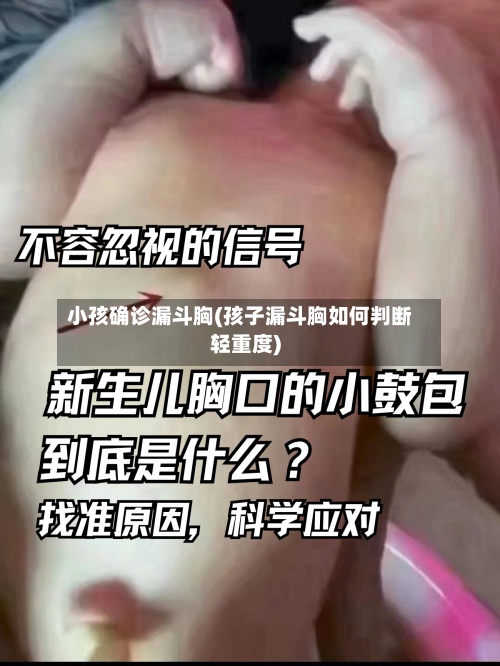 小孩确诊漏斗胸(孩子漏斗胸如何判断轻重度)-第1张图片