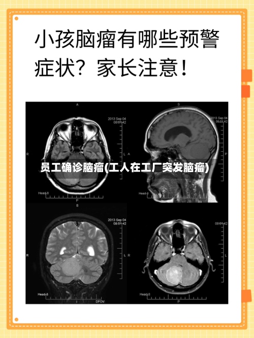 员工确诊脑瘤(工人在工厂突发脑瘤)