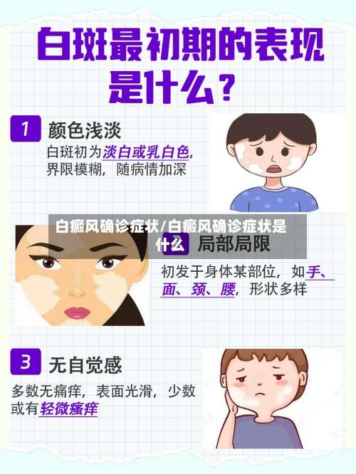 白癜风确诊症状/白癜风确诊症状是什么
