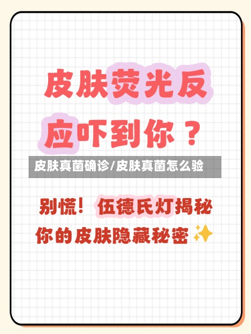 皮肤真菌确诊/皮肤真菌怎么验