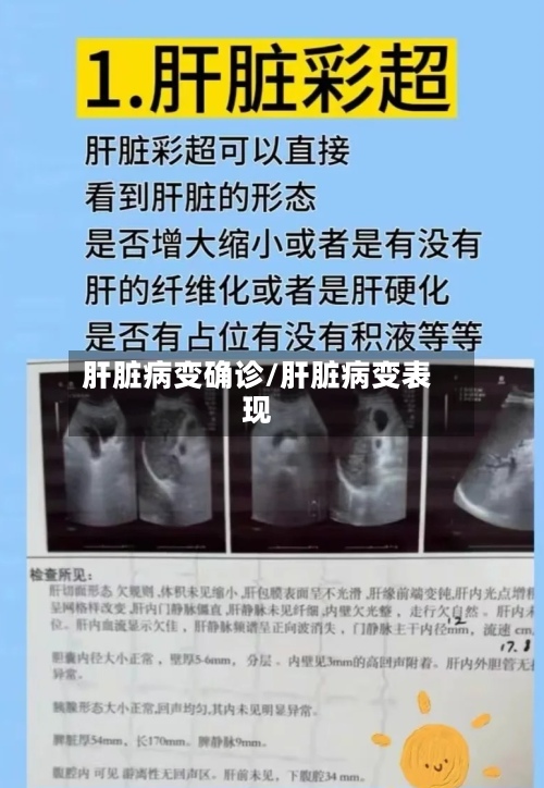 肝脏病变确诊/肝脏病变表现