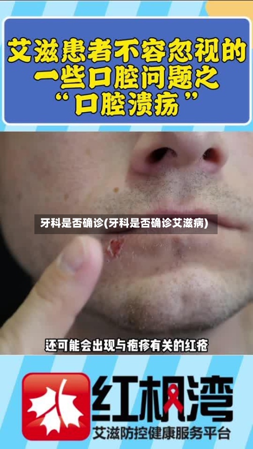 牙科是否确诊(牙科是否确诊艾滋病)-第2张图片