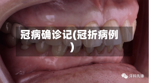 冠病确诊记(冠折病例)